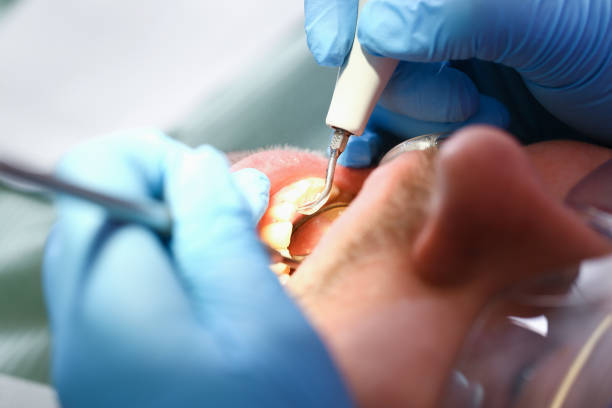 Best Walk-In Emergency Dental Services in Hayfield, VA