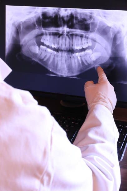 Best Emergency Root Canal Therapy in Hayfield, VA